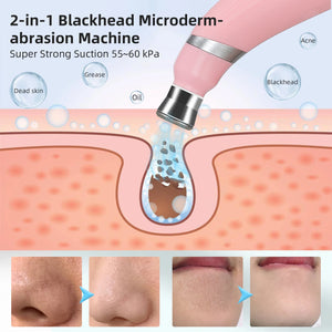 Professional Diamond Microdermabrasion Machine Home Use Facial Peeling Beauty Machine Exfoliation Face Deep Cleaning Skin Care